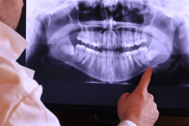 Best Broken or Chipped Tooth Repair in Dawsonville, GA